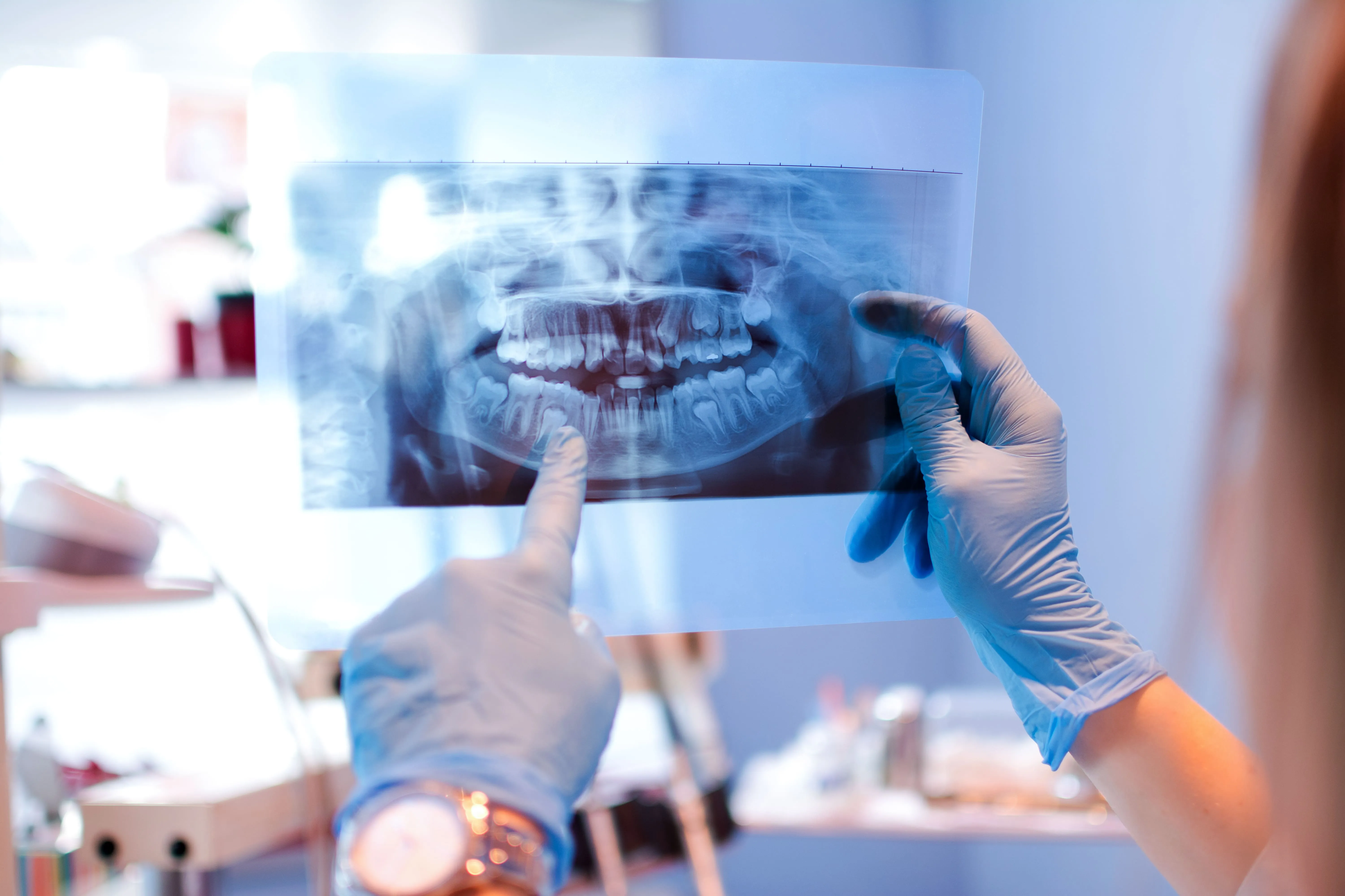 Dental Imaging Stock Image For Atlanta Dental